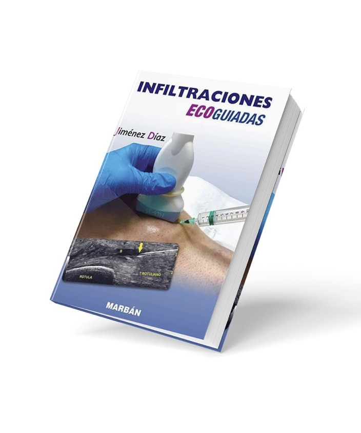 Libro Infiltraciones Ecoguiadas MSK - Premium
