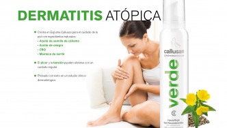 Alivio natural para la dermatitis atópica: Descubre Callusan Verde"