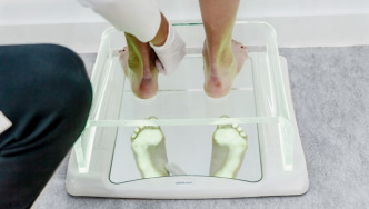 El Podoscopio, el sistema de análisis plantar imprescindible en la clínica podológica